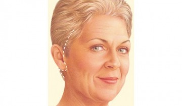 Yüz Germe Ameliyatları