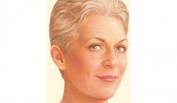 Yüz Germe Ameliyatları