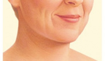 Yüz Germe Ameliyatları