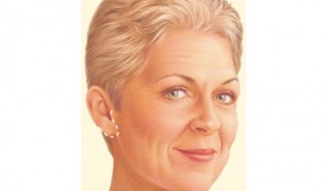 Yüz Germe Ameliyatları