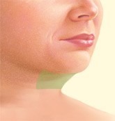 Yüz Dolgu Uygulamaları