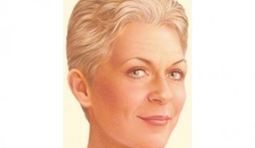 Yüz Germe Ameliyatları