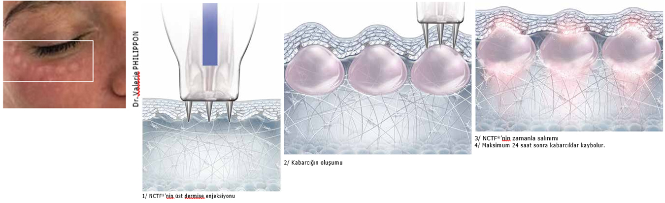 BİR SEANS SIRASINDA NE OLUR?