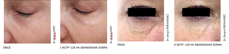 BİR SEANS SIRASINDA NE OLUR?