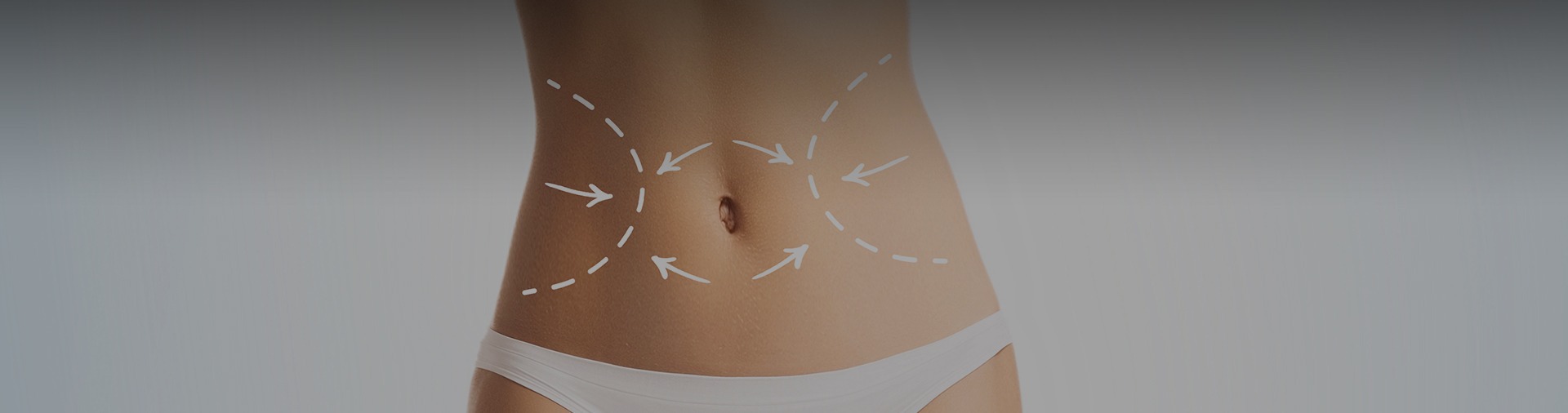 Yağ Aldırma, Liposuction